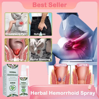 💥Herbal Hemorrhoids Spray - Permanent Removal & No Recurrence