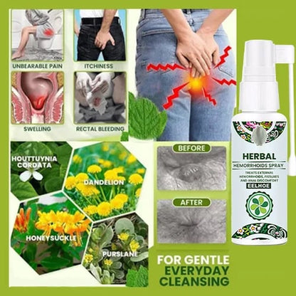 💥Herbal Hemorrhoids Spray - Permanent Removal & No Recurrence